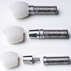 Dental implant parts