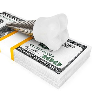 A dental implant on a stack of money